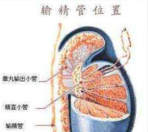 输精管堵塞的原因是什么?来东吴为您揪出病因