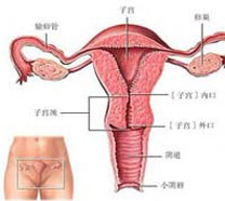 子宫内膜增厚破坏孕育土壤，应该如何治疗好？